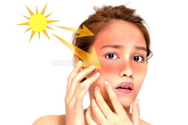 Bức xạ nhiệt gây tổn thương da của con người